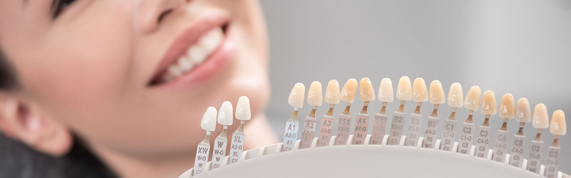 Dentist and patient matching veneers